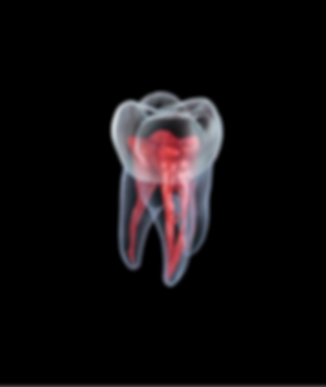 tooth2_edited_edited_edited.png