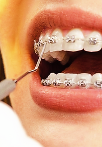 BRACKETS