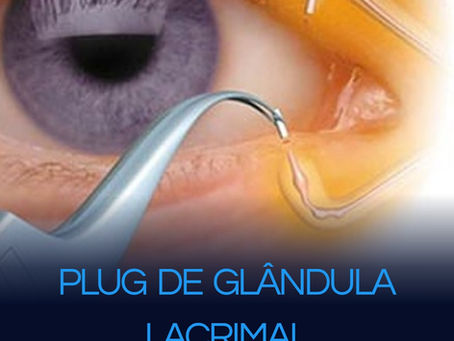 PLUG de Glândula Lacrimal