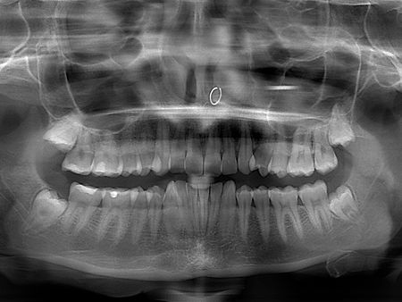 Panoramica-Dental-Clinica-Dental-MiBo-Almeria.jpg