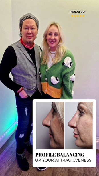 3 in 1, nose lips and chin job rhinoplasty in covent garden London without surgery