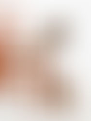 MARCHA EM EQUINO, VOCÊ JA OUVIU FALAR DESSA CONDIÇÃO?