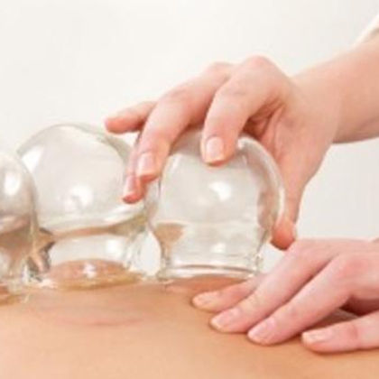 hijama.jpg