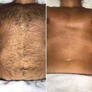 Chest/Stomach Waxing