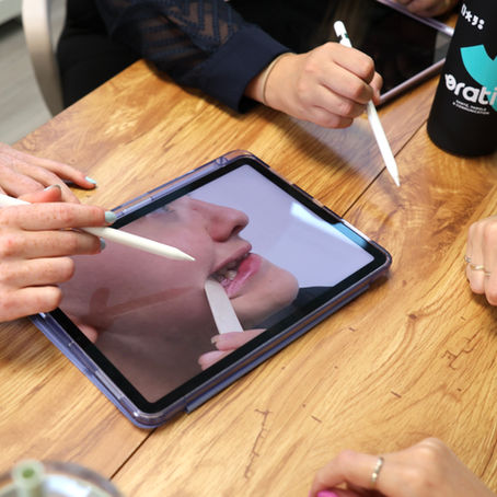 Discussion d'orthophonistes autour d'un dossier TOM (sigmatisme, chuintement, apex lingual, bords latériaux, maxillaire, mandibule, molocclusion, crêtes palatines, béance interlabiale, béance antérieure (open-bite), freins labiaux/ frein lingual, frénotomie/ frénectomie, surplomb vertical, surplomb horizontal, masséters, ATM (articulation temporo-mandibulaires), broyage antérieur)