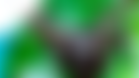 BMY/BAYN/JNJ Factor XI: Is the Market Mispricing Milvexian? Stroke valuation leverage underappreciated. AF optionality overlooked