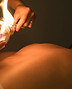 fire cupping