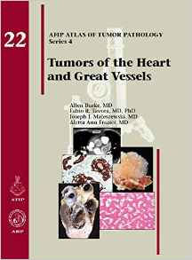 Tumors of the Heart and Great Vesse