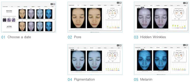 Thumbnail: Mei-Vu Facial Skin Analyzer