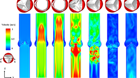 Fluid–structure interaction modeling of compliant aortic valves using the lattice Boltzmann CFD and FEM methods