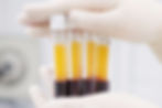 platelet rich plasms in tubes rj clinic