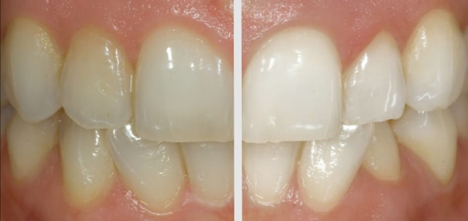 81926984_111126757086606_777256304239024