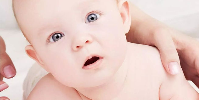 Image showing tight neck muscle in infant torticollis