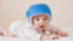 Picture of a baby with a blue helmet on.