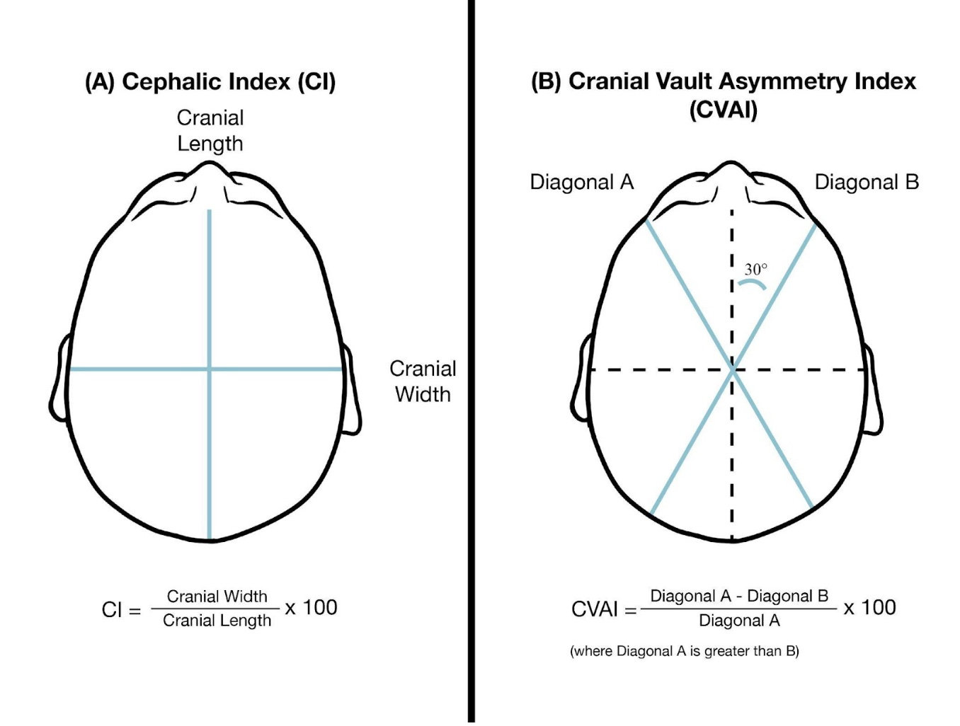 Plagiocephaly Measurements: ما هو مؤشر لقياس تسطح رأس الطفل CI ؟