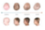 Visual comparison of normal baby head shape, plagiocephaly, and brachycephaly from above.