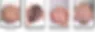 Image of brachycephaly. 
