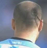 Thumbnail: via Factory Kid News via Rat Tail haircut