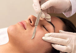 procedure-dermaplaning.jpg