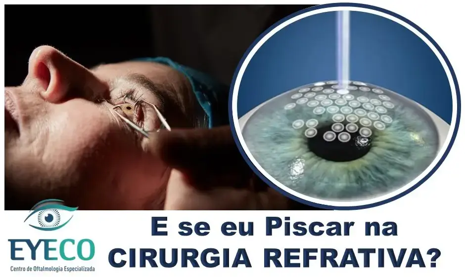 E se eu Piscar ou Mover o Olho durante a Cirurgia Refrativa?
