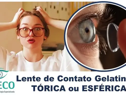 Lente de Contato Gelatinosa Tórica ou Esférica: qual é a ideal para você que tem Astigmatismo Leve?