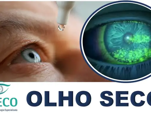 Síndrome do Olho Seco: Principais Causas, Sintomas e as Melhores Opções de Tratamento