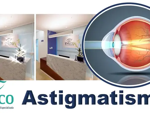 Visão Distorcida e Dores de Cabeça? Pode Ser Astigmatismo. Saiba Como Identificar e Tratar