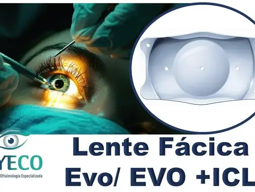 Lente Fácica Evo/ EVO +ICL: Tecnologia de Ponta para Corrigir Alta Miopia e Astigmatismo com Segurança