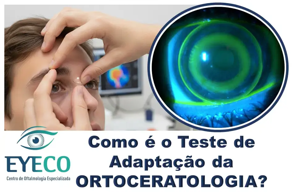 Como é o Teste de Adaptação com Lentes Ortho-k?