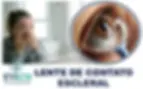 Lentes Esclerais para Casos Desafiadores