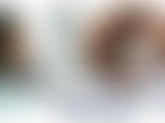 Lentes de Contato Esclerais: Solução de Correção Visual para Casos Desafiadores