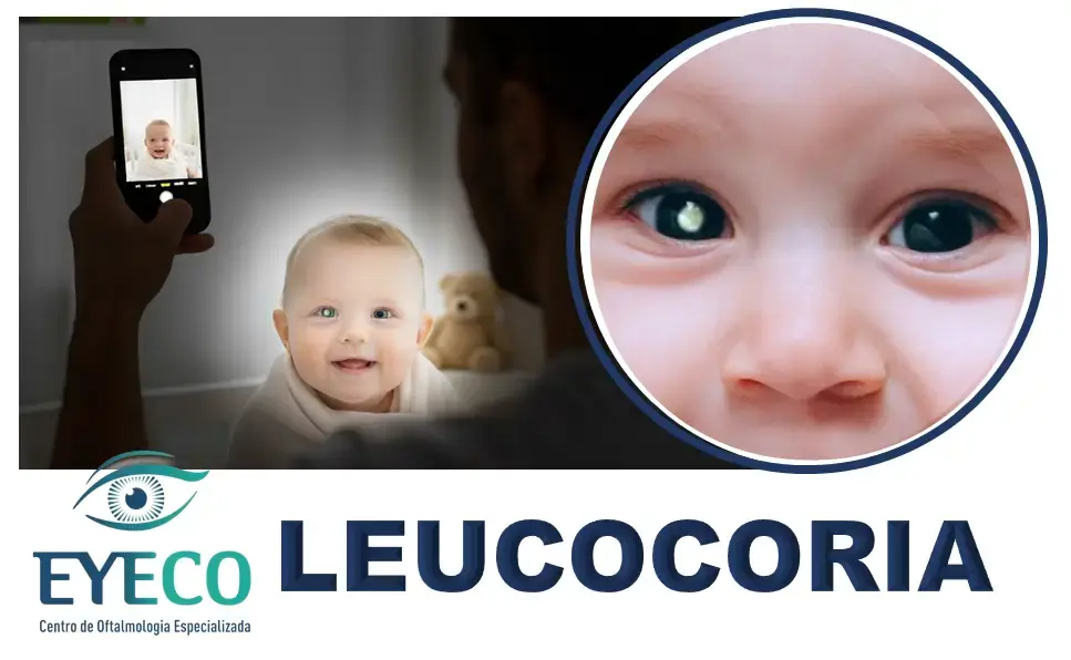 Leucocoria é um sinal ocular grave