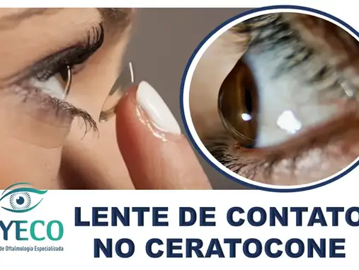 Lentes de Contato para Ceratocone: Descubra a Melhor Opção para Você