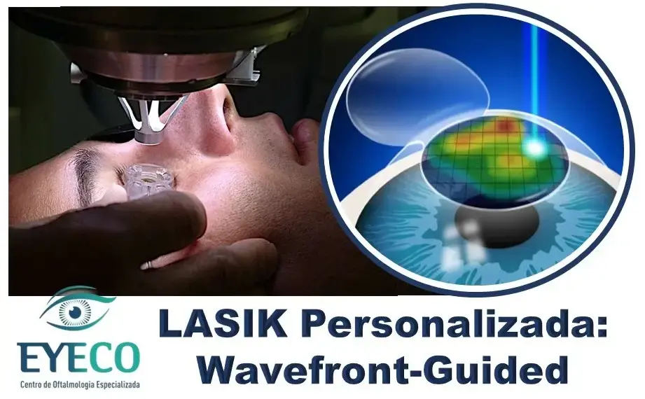 LASIK Personalizada: A Revolução da Cirurgia Refrativa com Tecnologia Wavefront-Guided