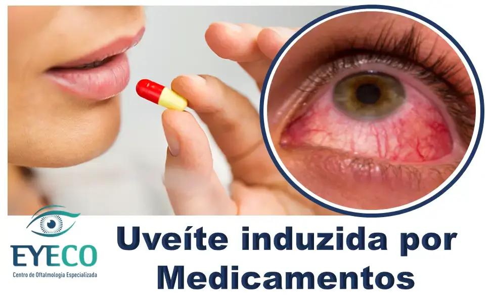 uveíte induzida por medicamentos