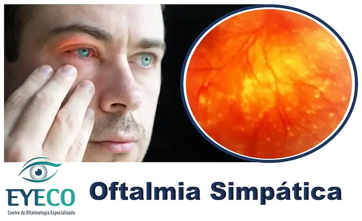 Oftalmia Simpática