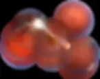 Granuloma Periférico por Toxocaríase Ocular