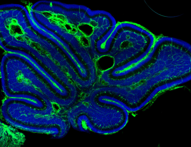 scitranslmed.adr0448-keyimage.gif