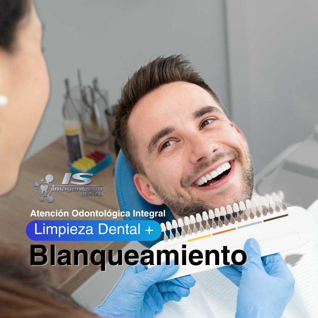 Pack: Limpieza + Blanqueamiento