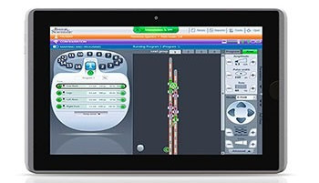 האם ניתן להשיג הקלה ממושכת בכאבי רגליים ובכאבי גב תחתון באמצעות גירוי חשמלי לחוט השדרה? LUMINA Study