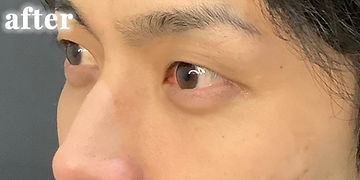 198,000円（税込）