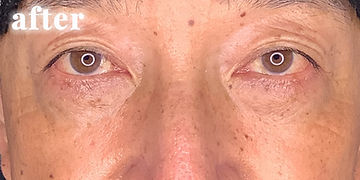 198,000円（税込）