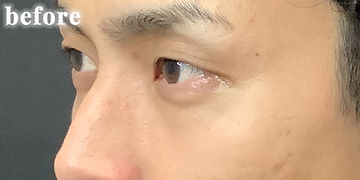 198,000円（税込）