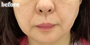 165,000円（税込）