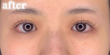 165,000円（税込）