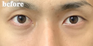 198,000円（税込）