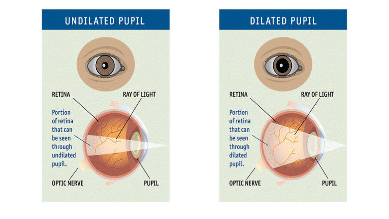can i drive after eye dilation uk