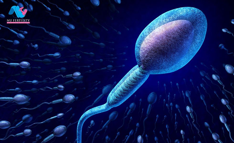 ree