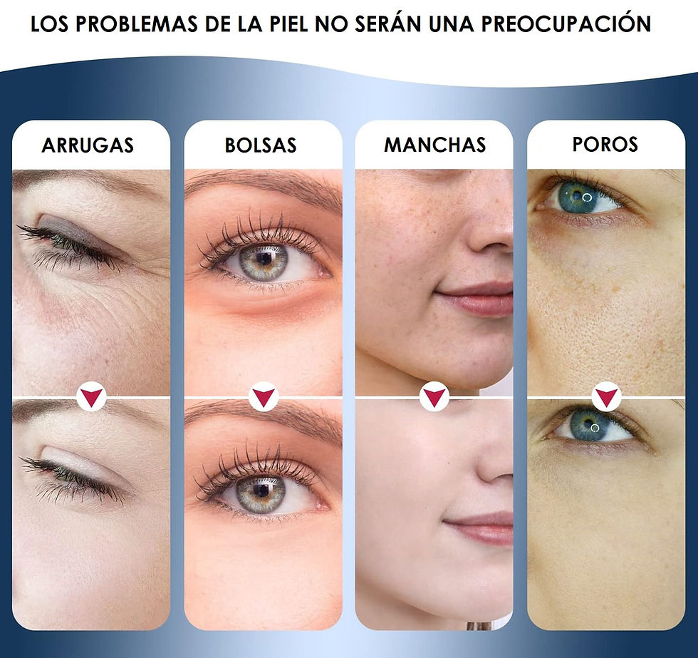 Miniatura: Masajeador Led Radiofrecuencia Facial