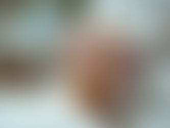 Transform Your Skin with Advanced Medspa Treatments